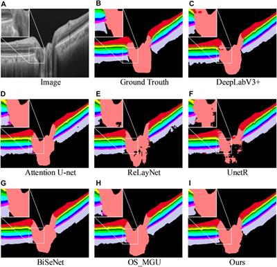 Exploiting multi-granularity visual features for retinal layer segmentation in human eyes